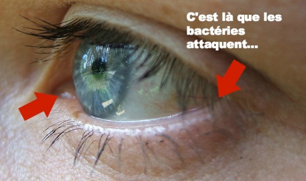 eye