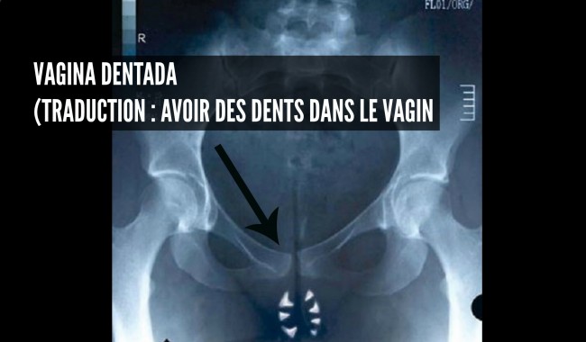 vagina