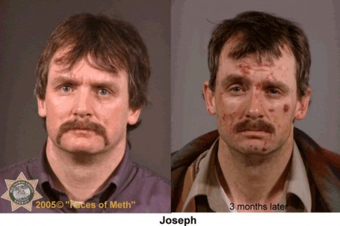 Top 33 des ravages terrifiants de la Meth en portraits avant / après