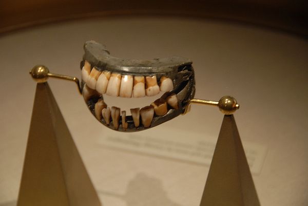 Les dents de George Washington_resultat