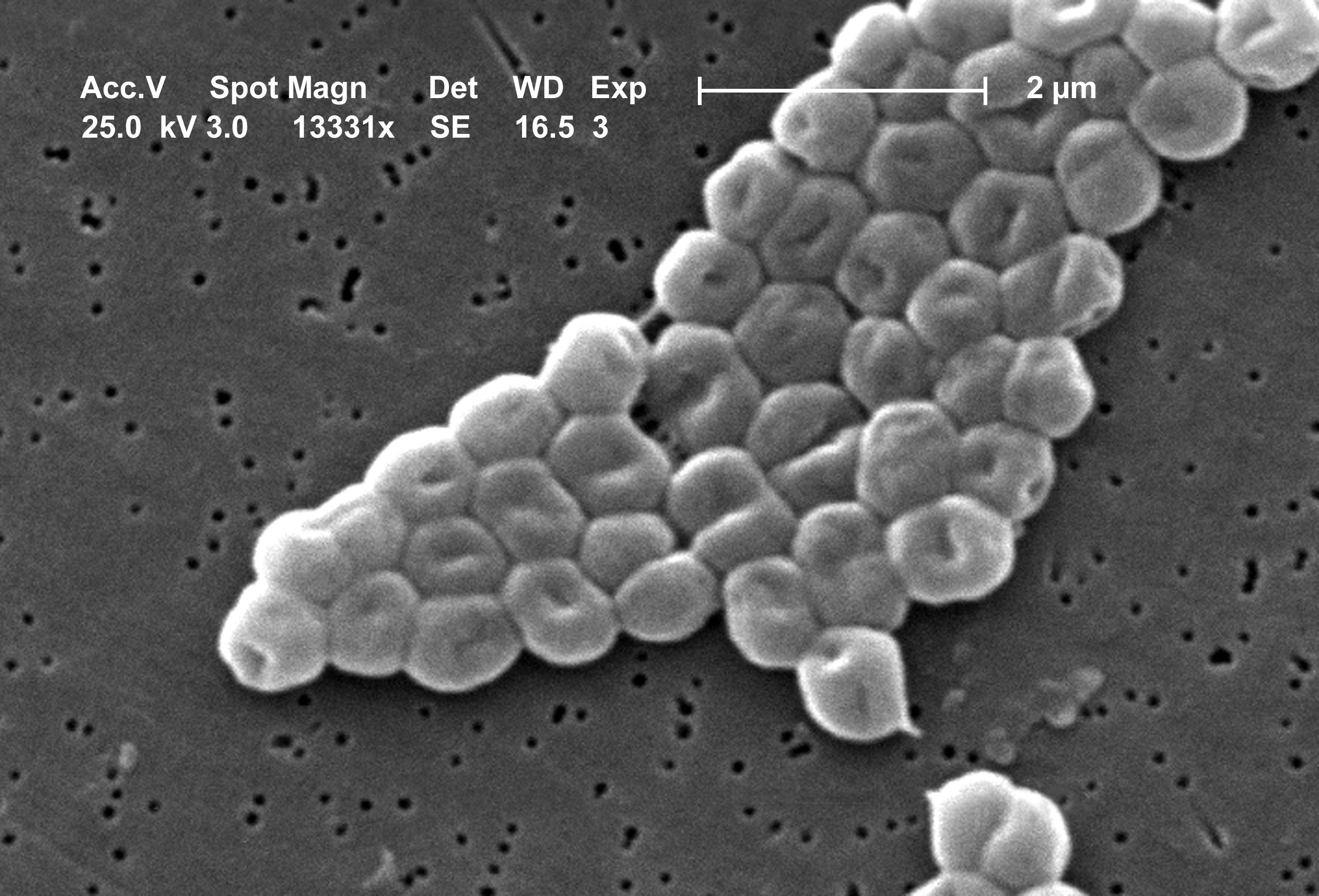 2004 Matthew J. Arduino, DRPH; Janice Carr This SEM depicts a highly magnified cluster of Gram-negative, non-motile Acinetobacter baumannii bacteria; Mag - 13331x. Members of the genus Acinetobacter are nonmotile rods, 1-1.5µm in diameter, and 1.5-2.5µm in length, becoming spherical in shape while in their stationary phase of growth. Acinetobacter spp. are widely distributed in nature, and are normal flora on the skin.  Some members of the genus are important because they are an emerging cause of hospital acquired pulmonary, i.e., pneumoniae, hemopathic, and wound infections.