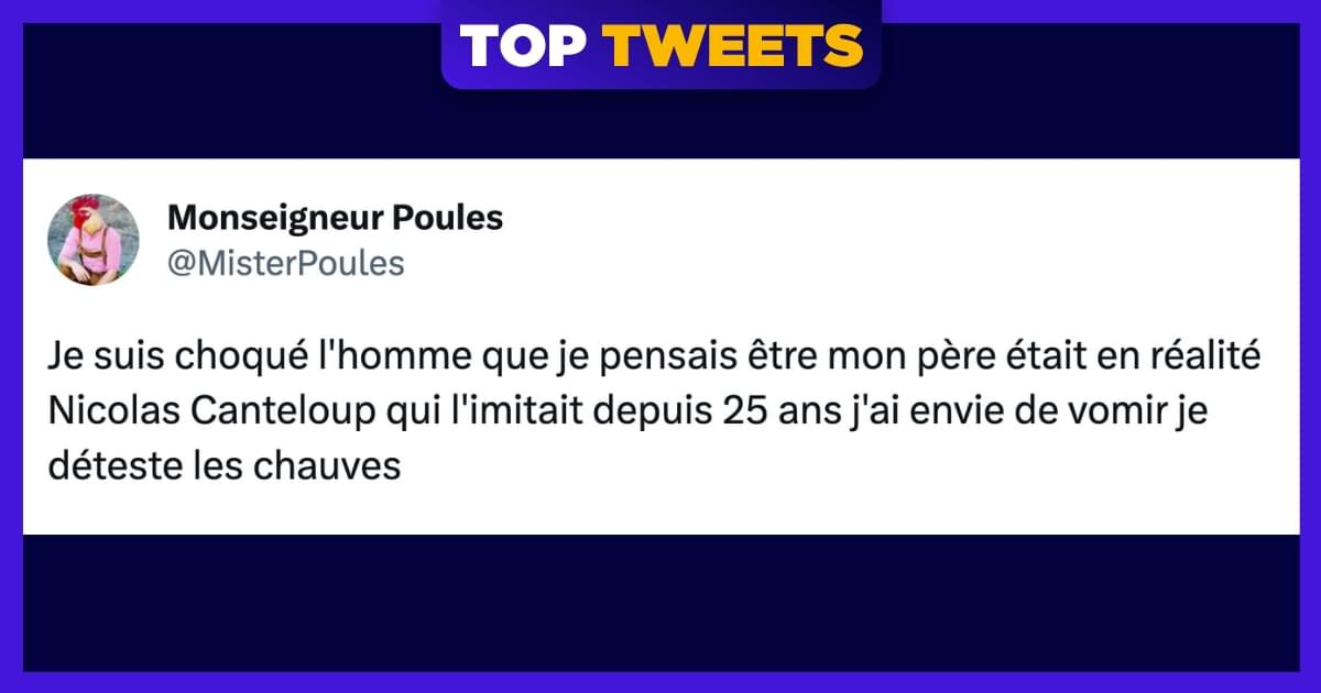 Top 14 des meilleurs memes sur les chauves, les crânes d'œuf